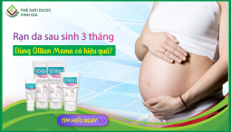 Rạn da 3 tháng sau sinh dùng Oillan Mama có hiệu quả không?